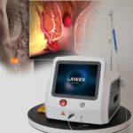 Quels sont les avantages des Hémorroïdes laser par rapport à une chirurgie classique ?